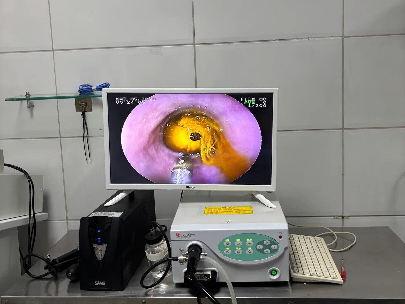 Equipamento exibindo um procedimento de endoscopia realizado no PetCampos